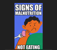 Signs of Malnutrition- Mali MUAC GIF